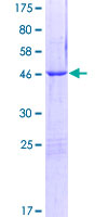 ab164445 on a 12.5% SDS-PAGE stained with Coomassie Blue.