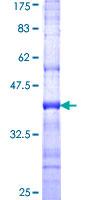 ab159952 on a 12.5% SDS-PAGE stained with Coomassie Blue.
