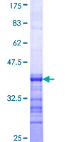 ab161354 on a 12.5% SDS-PAGE stained with Coomassie Blue.