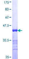 ab152924 on a 12.5% SDS-PAGE stained with Coomassie Blue.