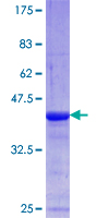 ab160503 on a 12.5% SDS-PAGE stained with Coomassie Blue.