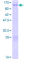 ab160919 on a 12.5% SDS-PAGE stained with Coomassie Blue.