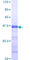 ab160920 on a 12.5% SDS-PAGE stained with Coomassie Blue.