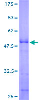 ab162968 on a 12.5% SDS-PAGE stained with Coomassie Blue.
