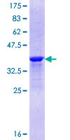 ab164278 on a 12.5% SDS-PAGE stained with Coomassie Blue.