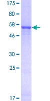 ab164412 on a 12.5% SDS-PAGE stained with Coomassie Blue.