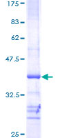 ab157873 on a 12.5% SDS-PAGE stained with Coomassie Blue.