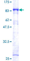 ab160754 on a 12.5% SDS-PAGE stained with Coomassie Blue.