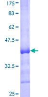 ab160755 on a 12.5% SDS-PAGE stained with Coomassie Blue.