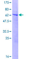 ab163918 on a 12.5% SDS-PAGE stained with Coomassie Blue.