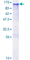ab157823 on a 12.5% SDS-PAGE stained with Coomassie Blue.
