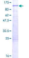 ab165245 on a 12.5% SDS-PAGE stained with Coomassie Blue.
