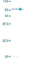 ab160138 on a 12.5% SDS-PAGE stained with Coomassie Blue.