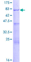 ab157820 on a 12.5% SDS-PAGE stained with Coomassie Blue.