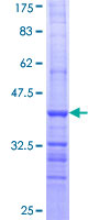 ab157876 on a 12.5% SDS-PAGE stained with Coomassie Blue.