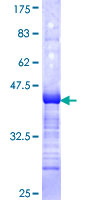 ab161255 on a 12.5% SDS-PAGE stained with Coomassie Blue.