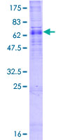 ab160867 on a 12.5% SDS-PAGE stained with Coomassie Blue.