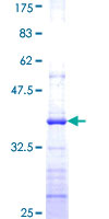 ab162245 on a 12.5% SDS-PAGE stained with Coomassie Blue.