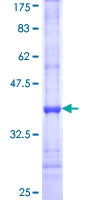 ab162270 on a 12.5% SDS-PAGE stained with Coomassie Blue.