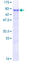 ab157880 on a 12.5% SDS-PAGE stained with Coomassie Blue.