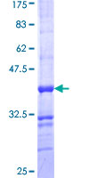 ab157881 on a 12.5% SDS-PAGE stained with Coomassie Blue.