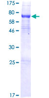ab162879 on a 12.5% SDS-PAGE stained with Coomassie Blue.