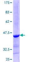 ab163244 on a 12.5% SDS-PAGE stained with Coomassie Blue.
