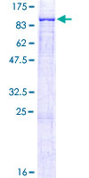 ab157877 on a 12.5% SDS-PAGE stained with Coomassie Blue.