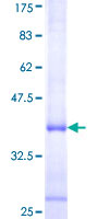 ab157878 on a 12.5% SDS-PAGE stained with Coomassie Blue.