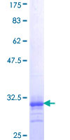 ab157861 on a 12.5% SDS-PAGE stained with Coomassie Blue.