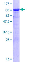 ab158226 on a 12.5% SDS-PAGE stained with Coomassie Blue.