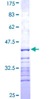 ab158227 on a 12.5% SDS-PAGE stained with Coomassie Blue.
