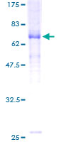 ab132904 on a 12.5% SDS-PAGE stained with Coomassie Blue.