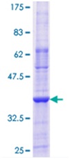 12.5% SDS-PAGE Stained with Coomassie Blue showing ab114545.