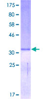 ab158273 on a 12.5% SDS-PAGE stained with Coomassie Blue.