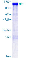 12.5% SDS-PAGE analysis of ab152166 stained with Coomassie Blue.