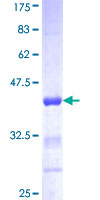 12.5% SDS-PAGE analysis of ab152167 stained with Coomassie Blue.