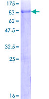 ab165321 on a 12.5% SDS-PAGE stained with Coomassie Blue.