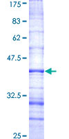 ab163093 on a 12.5% SDS-PAGE stained with Coomassie Blue.