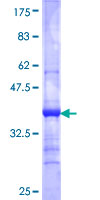 ab163094 on a 12.5% SDS-PAGE stained with Coomassie Blue.