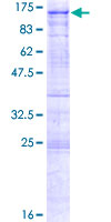ab164116 on a 12.5% SDS-PAGE stained with Coomassie Blue.