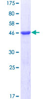 ab164117 on a 12.5% SDS-PAGE stained with Coomassie Blue.