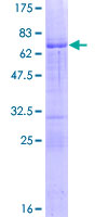 ab159945 on a 12.5% SDS-PAGE stained with Coomassie Blue.