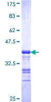 ab159946 on a 12.5% SDS-PAGE stained with Coomassie Blue.