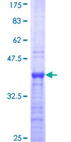 ab157882 on a 12.5% SDS-PAGE stained with Coomassie Blue.