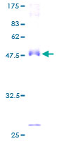 ab161708 on a 12.5% SDS-PAGE stained with Coomassie Blue.