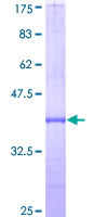 ab164677 on a 12.5% SDS-PAGE stained with Coomassie Blue.