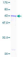 ab164678 on a 12.5% SDS-PAGE stained with Coomassie Blue.