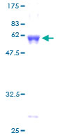 ab157885 on a 12.5% SDS-PAGE stained with Coomassie Blue.