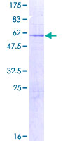 ab160731 on a 12.5% SDS-PAGE stained with Coomassie Blue.